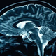 Illustration for article titled 10 Things an Electromagnetic Field Can Do to Your Brain
